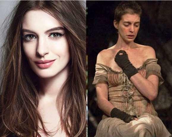 diaforetiko.gr : Anne Hathaway 9 Πανέμορφες γυναίκες ηθοποιοί που μεταμορφώθηκαν σε αποκρουστικές για τον ρόλο τους!