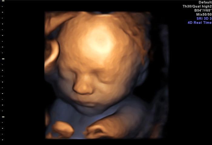 HD-4D: το νέο, ρεαλιστικό υπερηχογράφημα του μωρού σας! (βίντεο)