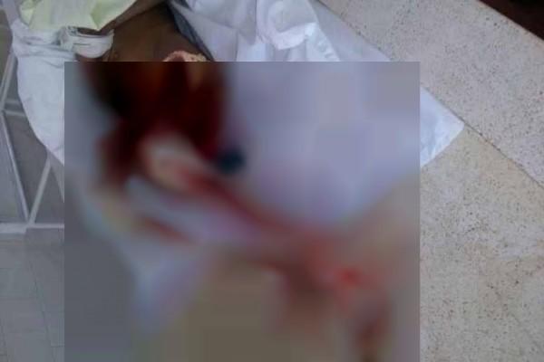 Τραγωδία στις διακοπές: Πιράνχας κατασπάραξαν 6χρονο κοριτσάκι (ΣΚΛΗΡΕΣ ΕΙΚΟΝΕΣ)