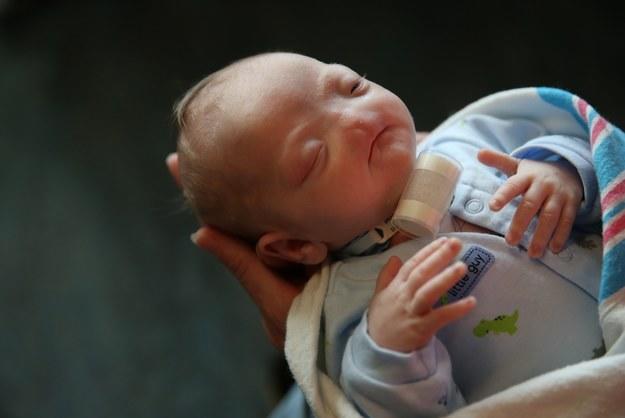 Γνωρίστε τον μικρούλη Eli: Το γλυκύτατο μωράκι που γεννήθηκε χωρίς μύτη!
