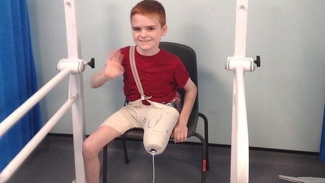 Συγκινεί η ιστορία του 11χρονου που ζητούσε να του ακρωτηριάσουν το πόδι