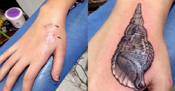 Αυτοί οι άνθρωποι καλύπτουν τις ουλές τους με φανταστικά τατουάζ. Μέρος 2ο (φωτογραφίες)