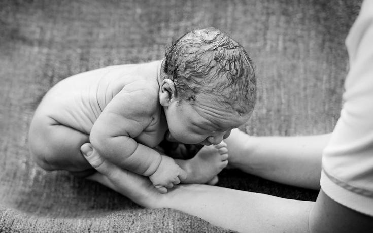 diaforetiko.gr : MORA1 Το θαύμα της ζωής: 10 Φωτογραφίες από βρέφη λίγα δευτερόλεπτα μετά τη γέννησή τους