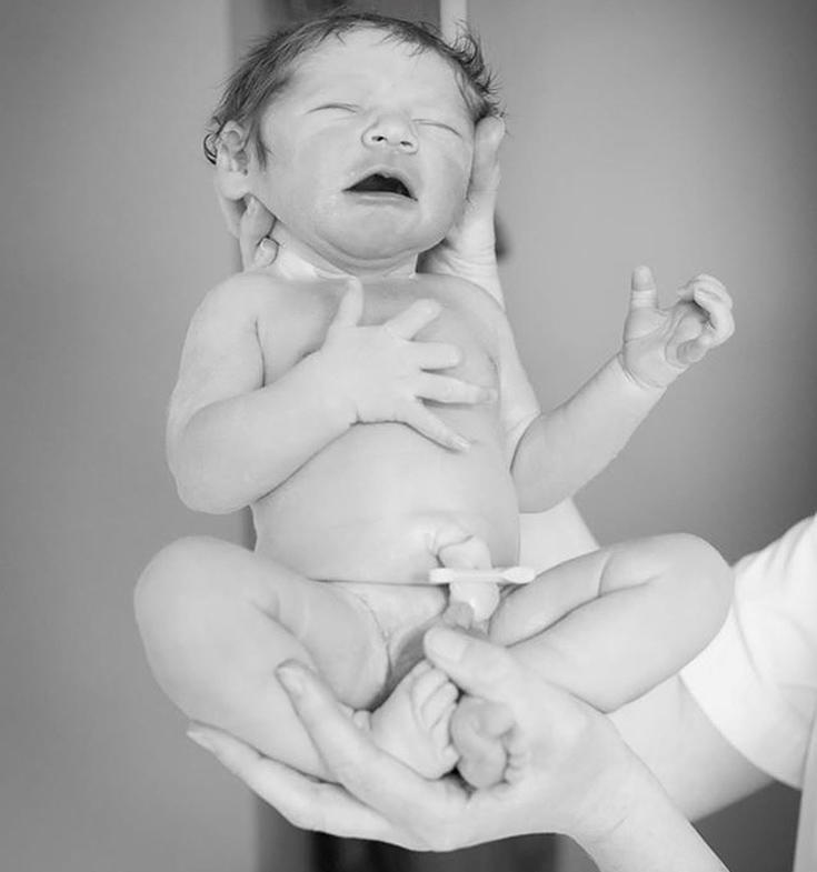 diaforetiko.gr : MORA6 Το θαύμα της ζωής: 10 Φωτογραφίες από βρέφη λίγα δευτερόλεπτα μετά τη γέννησή τους
