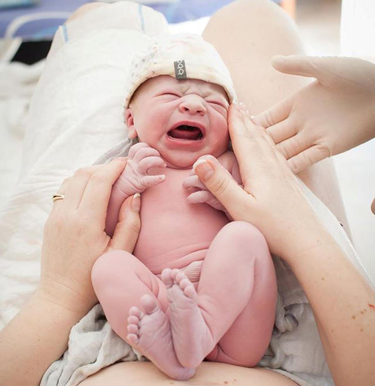 diaforetiko.gr : MORA8 Το θαύμα της ζωής: 10 Φωτογραφίες από βρέφη λίγα δευτερόλεπτα μετά τη γέννησή τους