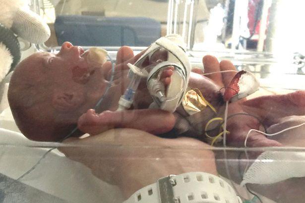 Οι γιατροί την προετοίμασαν πως θα χάσει το έμβρυο…Πήρε όμως ένα βιάγκρα και έσωσε το αγέννητο μωρό της!
