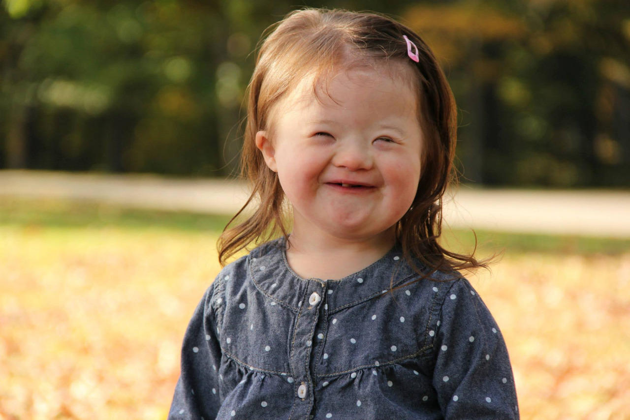 Yπέροχες φωτογραφίες δείχνουν πόσο γεμάτα ευτυχία και αγάπη είναι τα παιδιά με Σύνδρομο Down