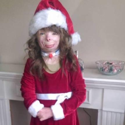 This little girl's amazing outlook on life is truly an inspiration, and we're hoping she has the best Christmas ever.