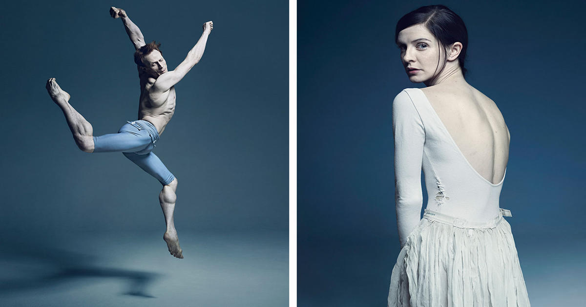Ο αφόρητος πόνος και οι θυσίες των χορευτών μπαλέτου μέσα από μία σειρά φωτογραφιών