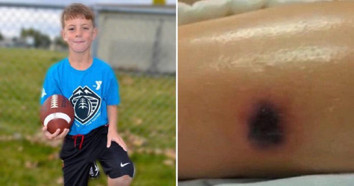 10χρονο αγόρι πεθαίνει 2 εβδομάδες μετά την εμφάνιση ενός παράξενου σημαδιού στο πόδι του.