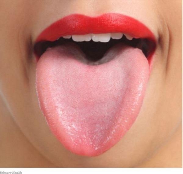Here's what a healthy tongue should look like.