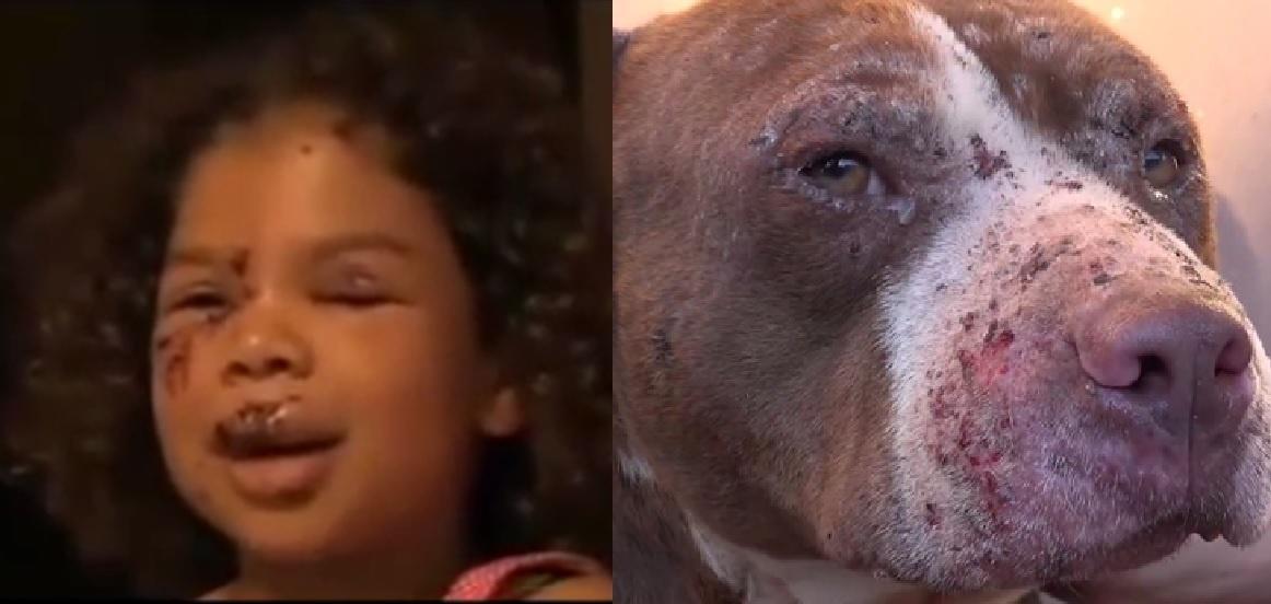 Her family's pit bull, Trigger, jumped over the fence when he saw his human attacked. 