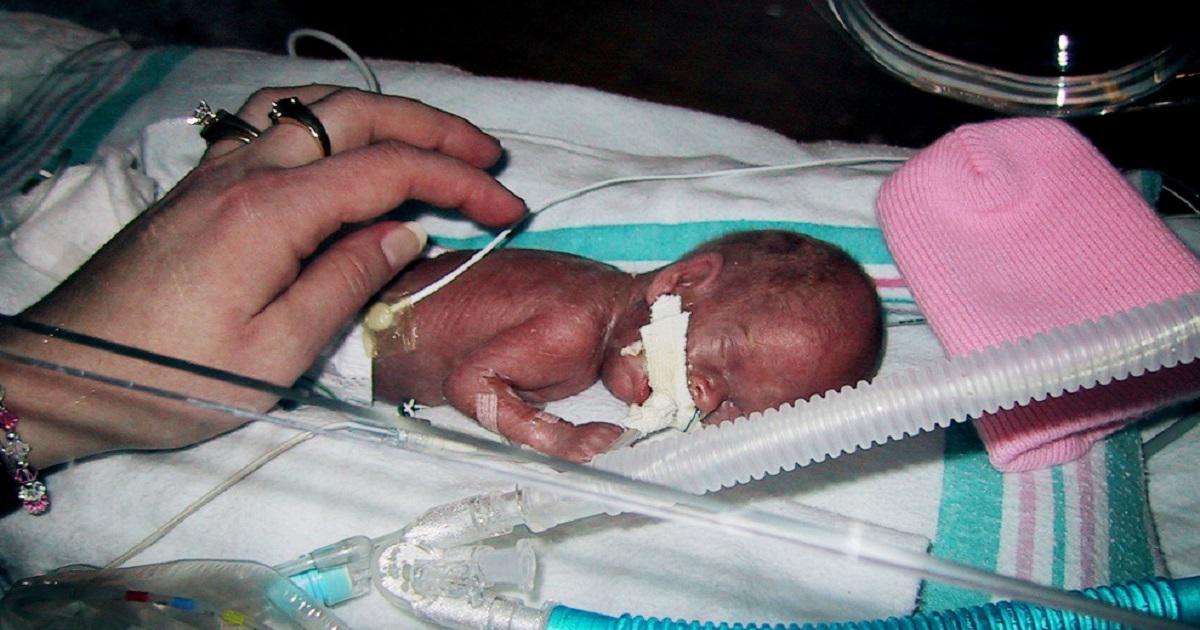 Μια μητέρα ετοιμάζονταν να κηδέψει το μικροσκοπικό πρόωρο μωρό της, 12 χρόνια μετά η κόρη της μοιάζει τόσο διαφορετική