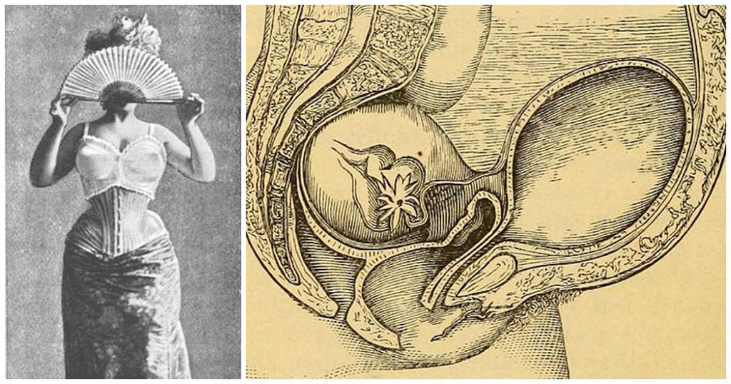 10 εξωφρενικά πράγματα που πίστευαν οι άνθρωποι για το γυναικείο σώμα στο παρελθόν