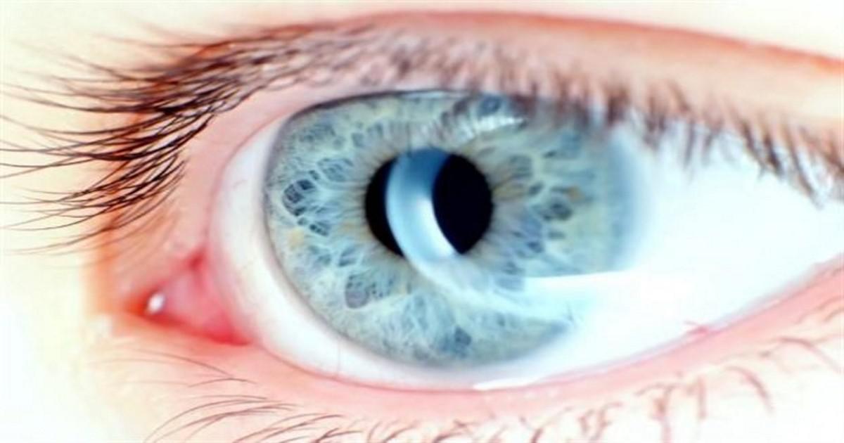 ΣΤΑΜΑΤΗΣΤΕ ΤΗΝ ΤΩΡΑ! Γιατροί συνδέουν την τύφλωση με αυτή την καθημερινή μας συνήθεια