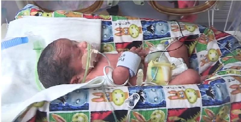 The girls were breathing on their own, while the two boys needed breathing tubes.