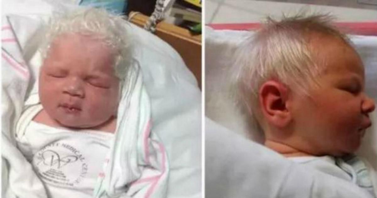 Αυτό το αγοράκι γεννήθηκε με κάτασπρα μαλλιά και έχει ξετρελάνει το διαδίκτυο