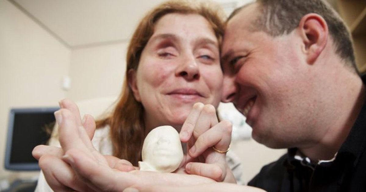 Τυφλό ζευγάρι δεν μπορούν να δουν τον υπέρηχο του μωρού τους αλλά ο γιατρός τους δίνει την ευκαιρία να το «αισθανθούν»