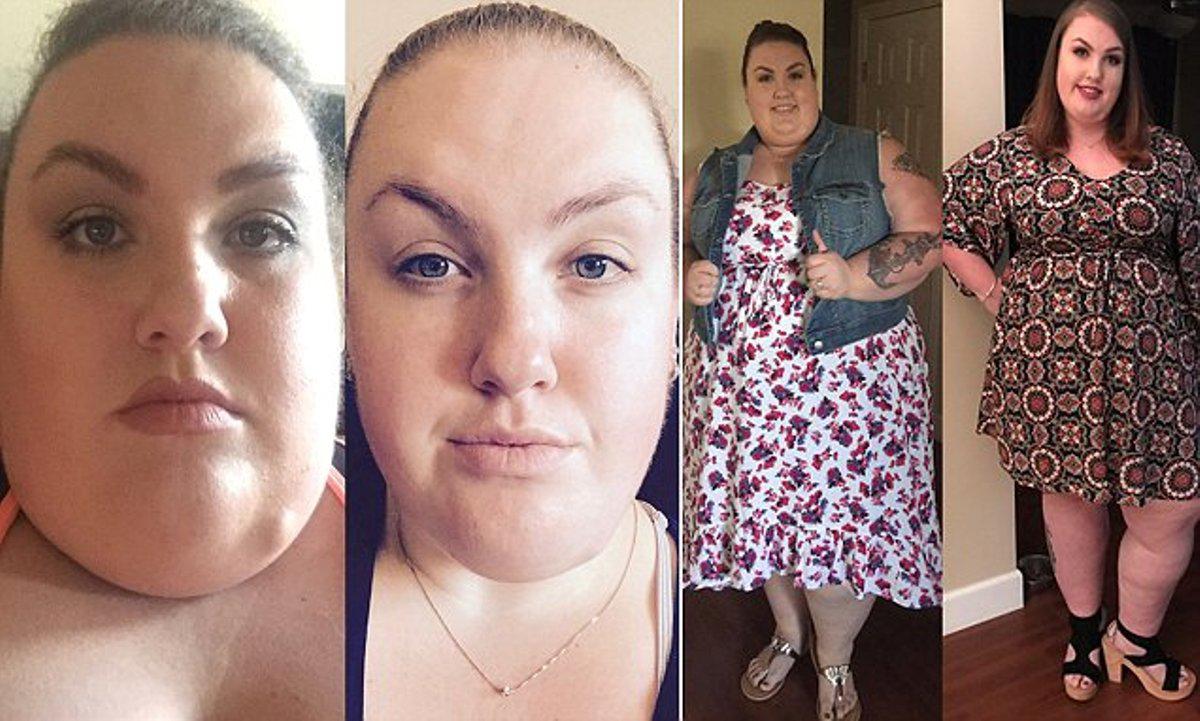 Πως το αδυνάτισμα αλλάζει εντελώς την εμφάνιση ενός ανθρώπου: Αυτή η γυναίκα έχασε 76 κιλά και. προσέξτε το πρόσωπό της
