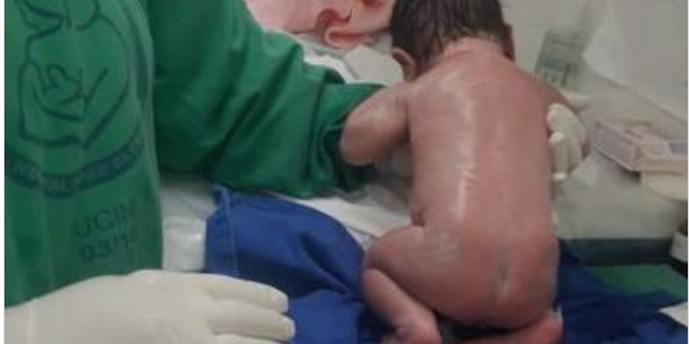 Νεογέννητο περπατάει λίγες μόλις ώρες μόνο μετά τη γέννηση του