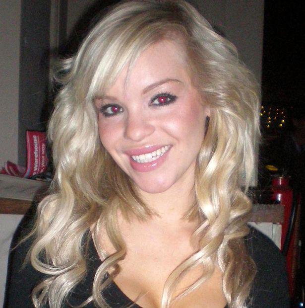 katie-piper-who-was-the-victim-of-a-rape-and-an-acid-attack-by-a-jealous-boyfriend