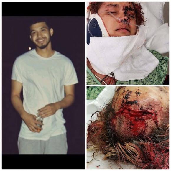 Photo collage posted by Juanita Torres on social media shows Dameon Marmolejo (L) and the wounds he caused by brutally beating Solidad Analyssa Marie Torres (R) in June 2017. (Facebook)