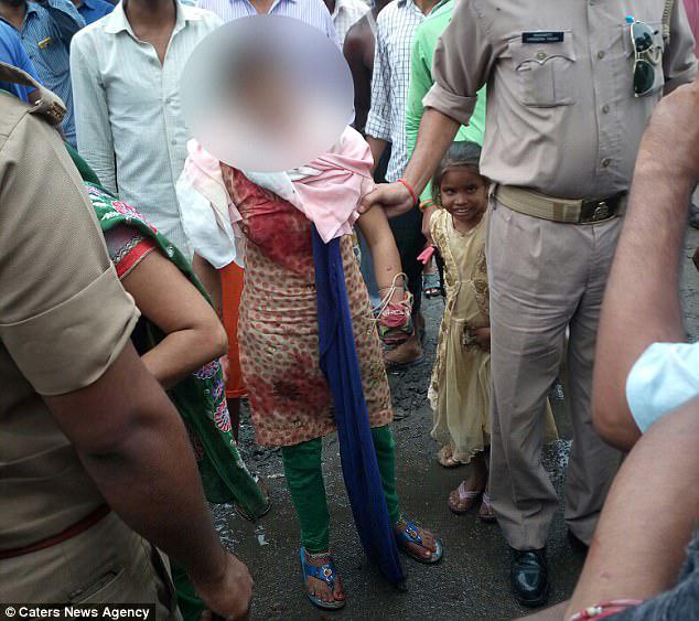 Ένας παλαίμαχος εραστής κόπηκε από ένα χέρι 15χρονων μαθητών με ένα σπαθί σε μια πολυσύχναστη ινδική αγορά σε ευρύ φως της ημέρας