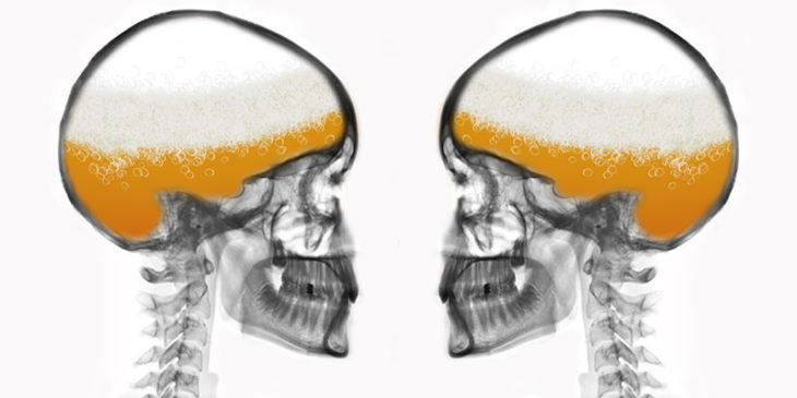 2 ποτήρια μπύρας είναι πιο αποτελεσματικά για την ανακούφιση του πόνου από τα παυσίπονα