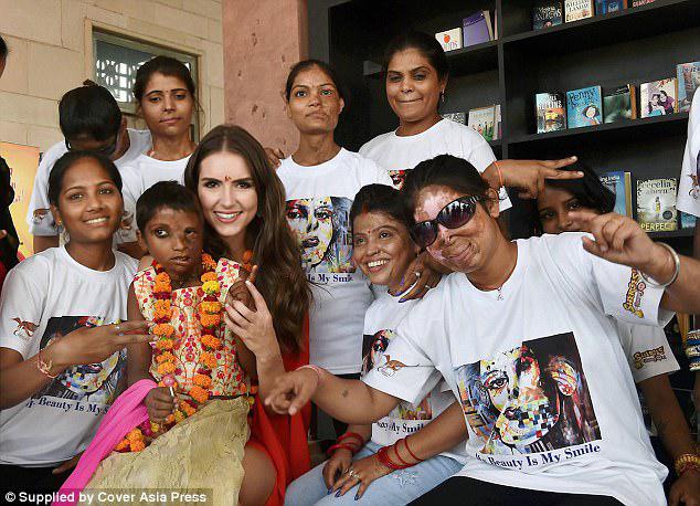 Charity: Anna spent time meeting acid attack survivors during the visit to India last week 