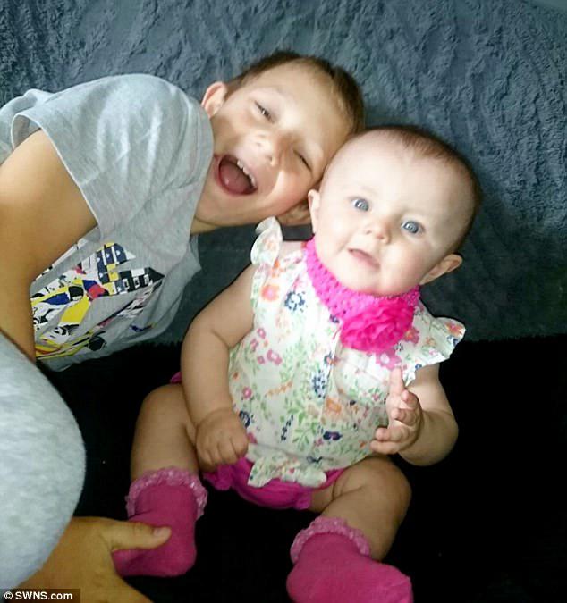 Kia developed a rash across her body two months ago (before with her brother Kayden, eight)