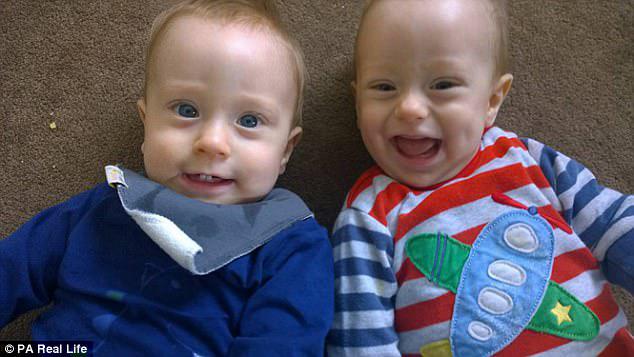 Reuben, left, and Theo, right, shared a single amniotic sac but cheated death in the womb by hugging each other