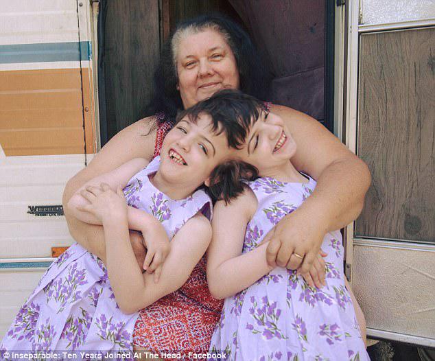 When Tatiana and Krista (pictured with their grandmother), were born, their parents, Felicia and Brendan, were warned to prepare for the worst as the children were not expected to survive the day