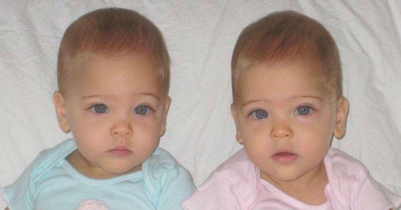 Δίδυμα κορίτσια γεννήθηκαν το 2010 είναι σήμερα τα πιο όμορφα παιδιά του κόσμου