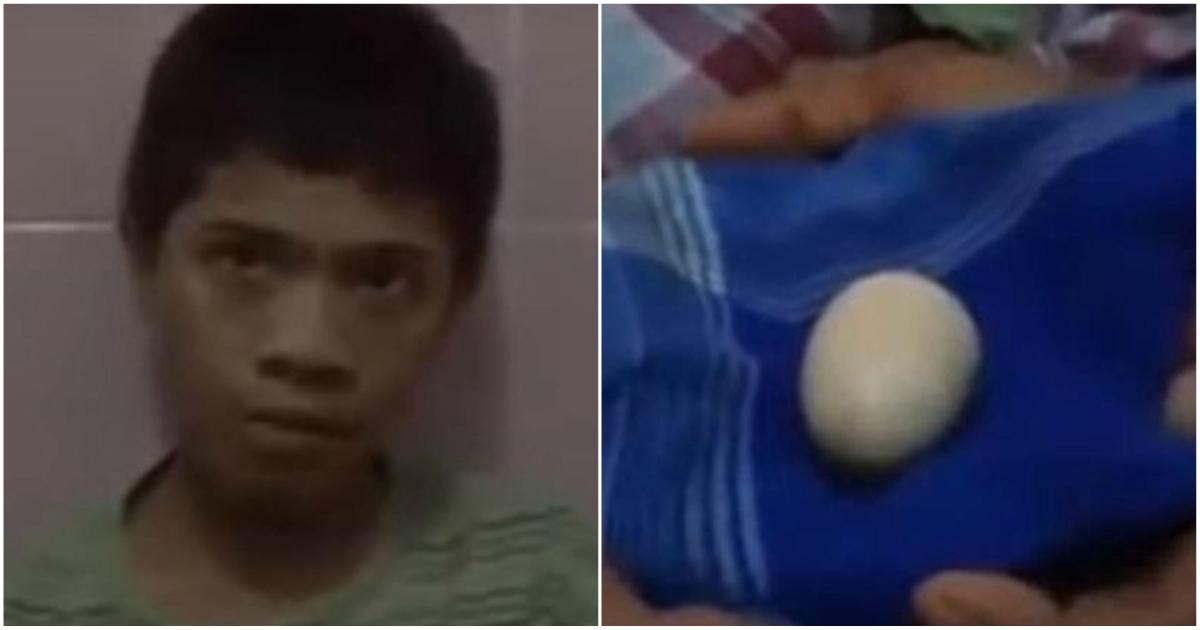 14χρονος στην Ινδονησία «γεννάει» αυγά και οι επιστήμονες σηκώνουν τα χέρια ψηλά