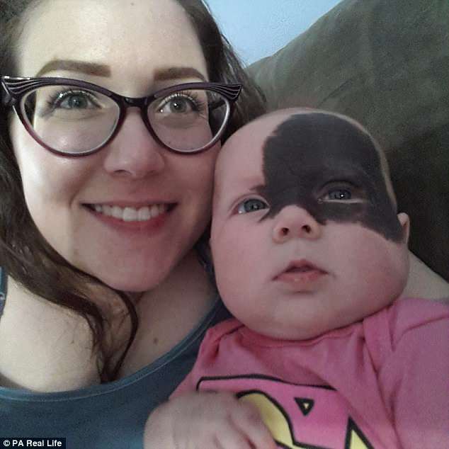 Natalie's mother Lacey (pictured) believes the blemish will make her daughter strongerÂ 