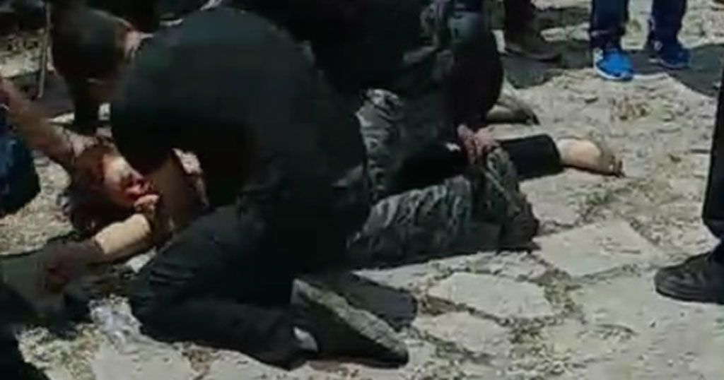 Διαδηλώτρια τραυματίστηκε βαριά στο κεφάλι από αστυνομικούς στις Πρέσπες