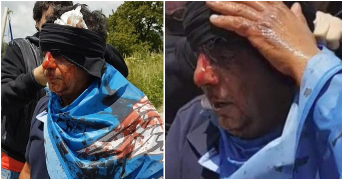 Άνδρας ξυλοκοπήθηκε από την ΕΛ.ΑΣ στην συγκέντρωση για τη Μακεδονία και μάτωσε η σημαία που είχε πάνω του