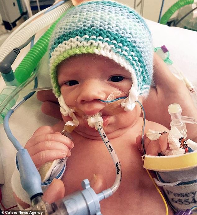 Â Kaleb Brook suffered oxygen deprivation either in the womb or at birth, giving him severe brain damage. At ten days old, doctors decided to withdraw all careÂ 