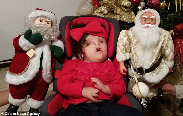 Helianny, pictured at Christmas, has undergone four surgeries so far, two to drain fluid from her brain, the third to correct her clubbed foot and another to reconnect her cleft lip