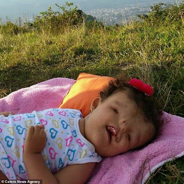 The family have been targeted with cruel comments ranging from Helianny (pictured as a toddler) being called 'ugly' to her parent's being told they should have aborted her