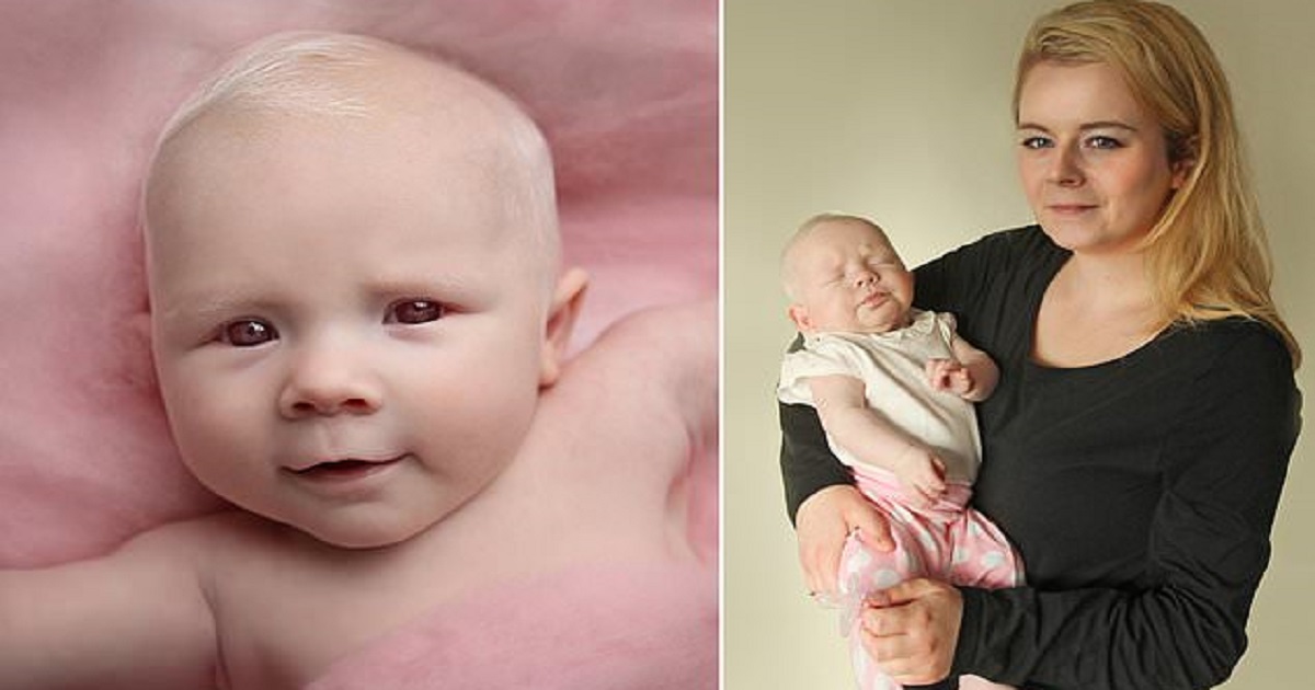 Μητέρα έφερε στον κόσμο ένα πανέμορφο μωρό αλμπίνο παρόλο που οι γιατροί της έλεγαν ότι δεν μπορεί να κάνει παιδί