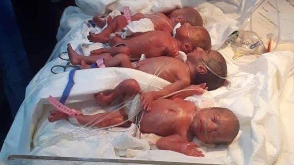 25χρονη γυναίκα γέννησε με φυσικό τοκετό επτάδυμα σε νοσοκομείο του Ιράκ