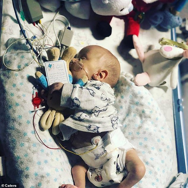 George Bownes was born three months prematurely, and at just six minutes old he was put on a life support machine. Pictured, the baby in hospital