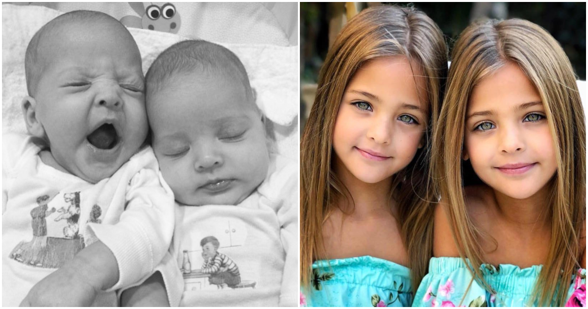 Δίδυμα κοριτσάκια γεννήθηκαν πριν 8 χρόνια και έγιναν μοντέλα και σήμερα είναι τα ωραιότερα παιδιά του κόσμου