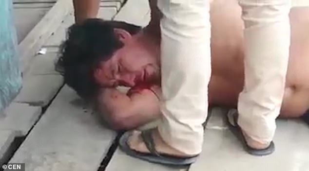 Video footage shows the man lying bleeding outside the bar