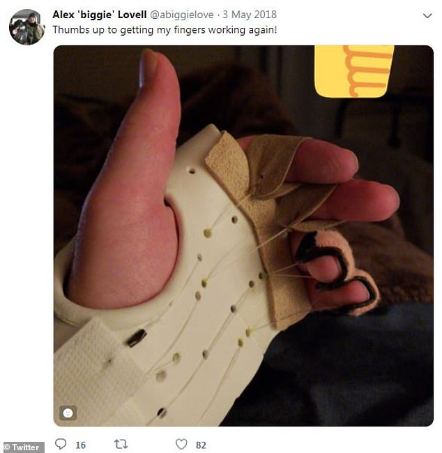 Lovell said he takes comfort that he was able to defend himself from a 'samurai wannabe crazy lady with hate in her heart'. He shared a pic of his fingers that were almost completely cut off