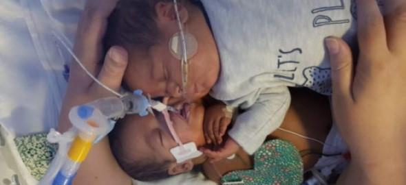 Νεογέννητο κόντεψε να πεθάνει αλλά τον έσωσε η αγκαλιά του δίδυμου αδερφού του