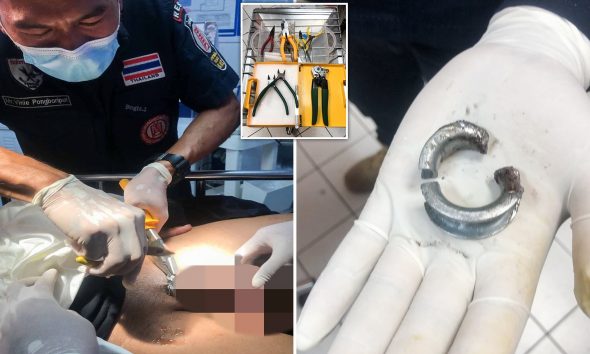Άντρας έβαλε δαχτυλίδι στο μόριο του για του Αγίου Βαλεντίνου και κατέληξε στο νοσοκομείο