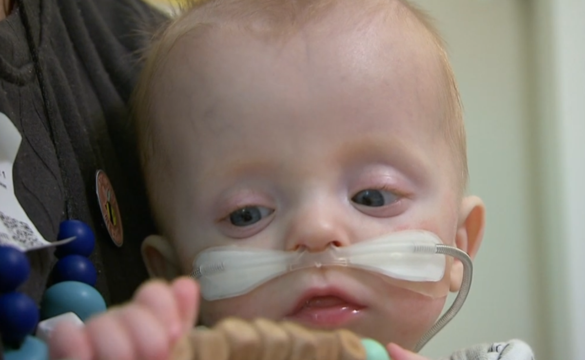 Μωρό που γεννήθηκε στις 23 εβδομάδες έκανε 8 χειρουργεία και επέζησε