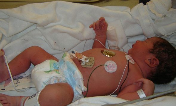 Ο Έλληνας γιατρός που υπέστη έμφραγμα την ώρα της γέννας αλλά αψήφησε το θάνατο για να σώσει τη ζωή του μωρού
